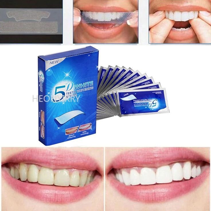 Fitas Clareadoras Dentais 5D White Teeth Whitening Strips – Kit Clareamento Dental Caseiro de Alta Eficiência